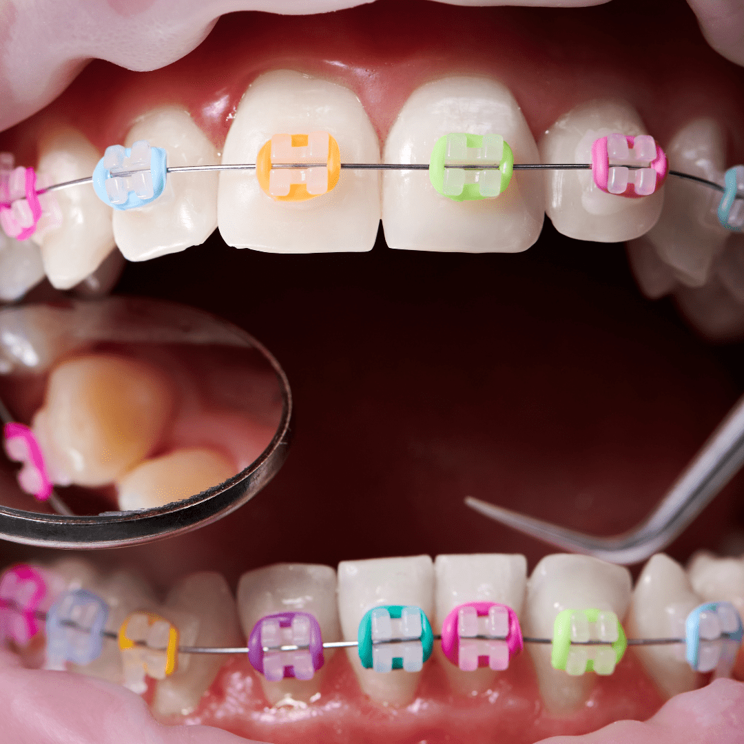 Bases Fundamentales de la Ortodoncia: Sonrisas en Armonía
